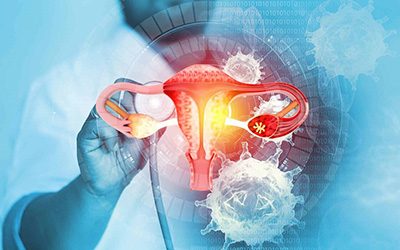 SMART PREVENTION OF CANCER IN GYNECOLOGY